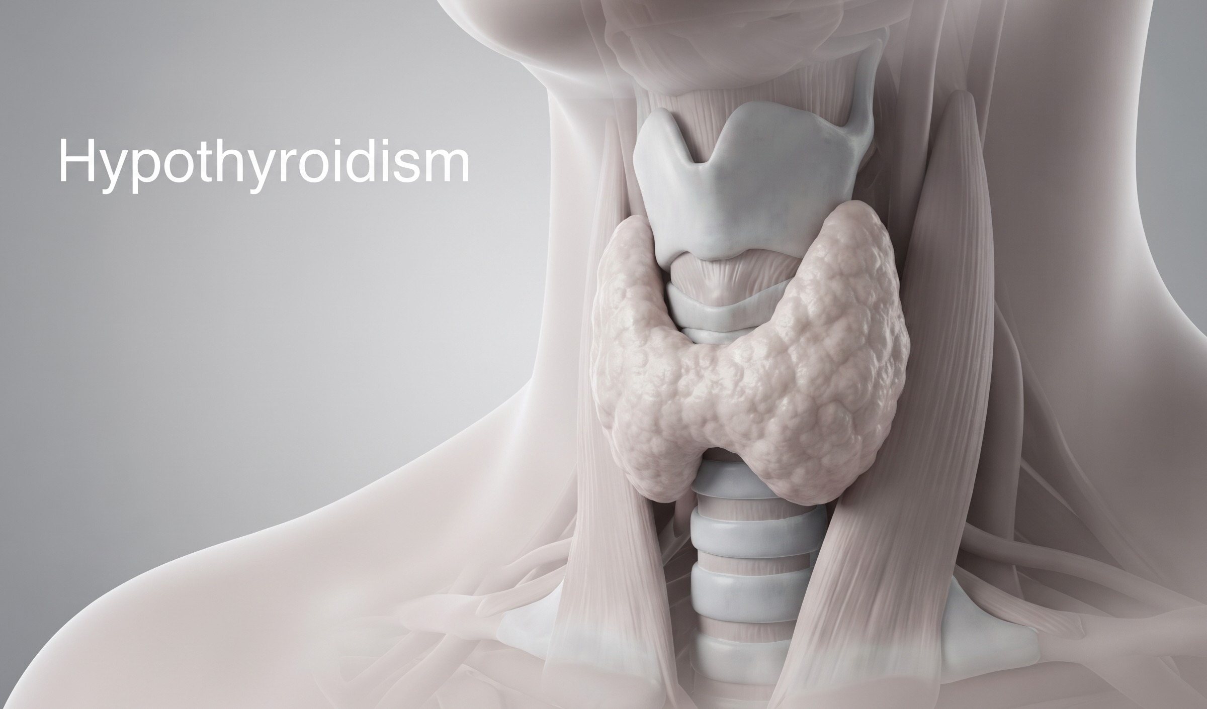 کم‌کاری تیروئید (Hypothyroidism) : هر آنچه باید درباره رژیم غذایی و مکمل‌های مورد نیازش بدونی